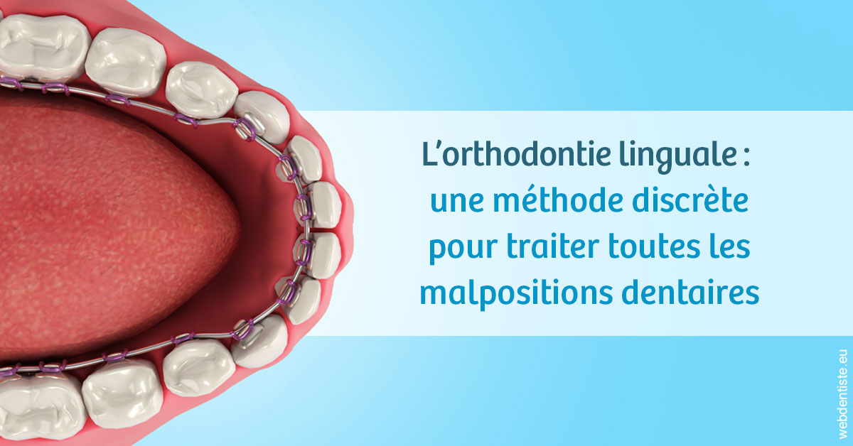 https://dr-olivier-lemaire.chirurgiens-dentistes.fr/L'orthodontie linguale 1