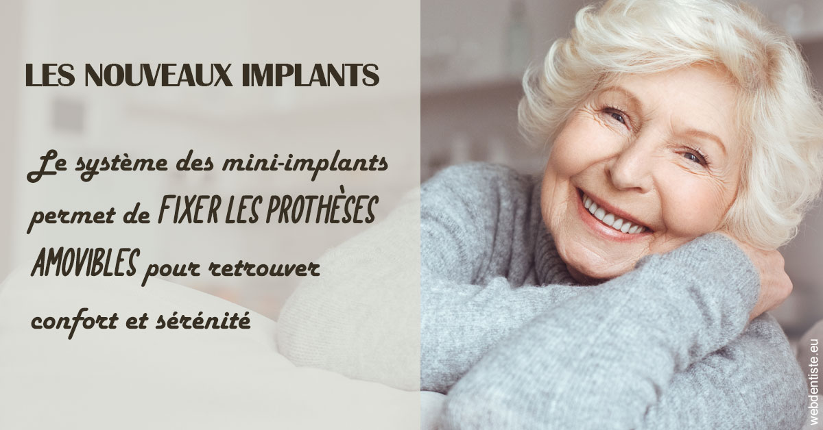 https://dr-olivier-lemaire.chirurgiens-dentistes.fr/Les nouveaux implants 1