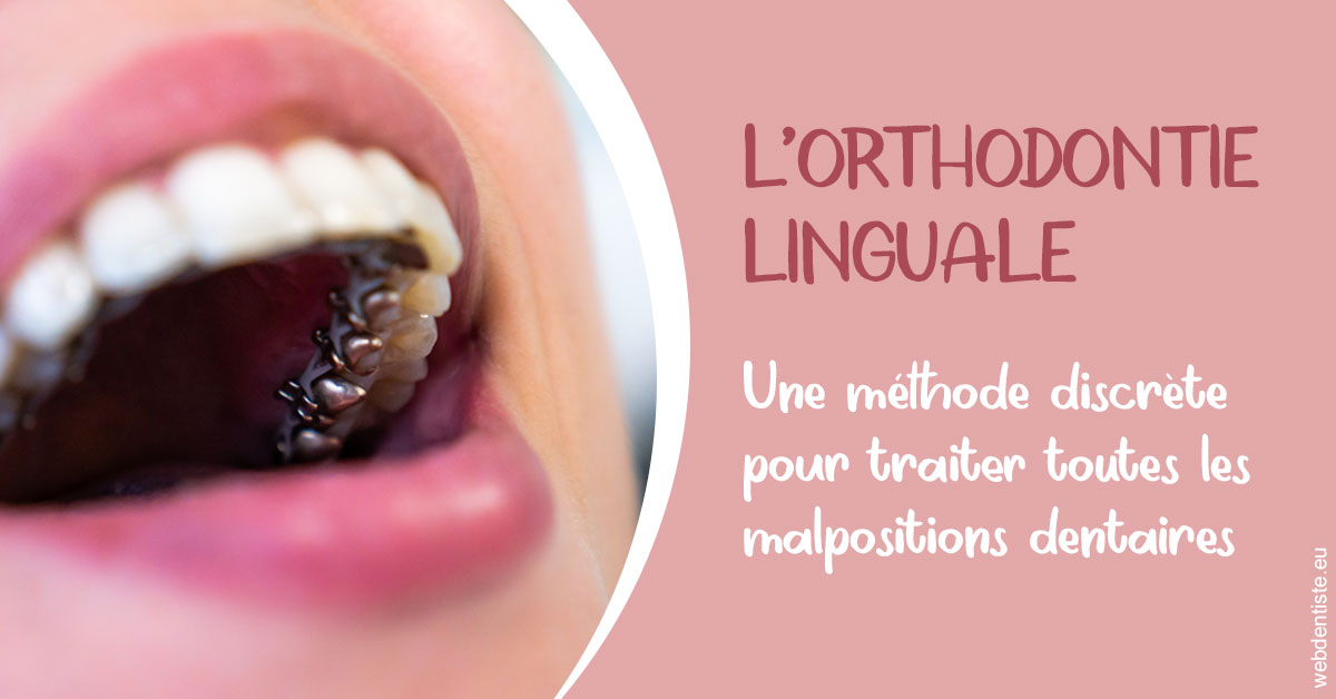 https://dr-olivier-lemaire.chirurgiens-dentistes.fr/L'orthodontie linguale 2