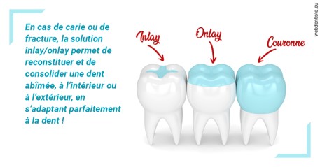 https://dr-olivier-lemaire.chirurgiens-dentistes.fr/L'INLAY ou l'ONLAY