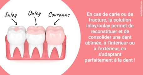 https://dr-olivier-lemaire.chirurgiens-dentistes.fr/L'INLAY ou l'ONLAY 2