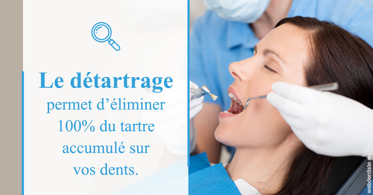 https://dr-olivier-lemaire.chirurgiens-dentistes.fr/En quoi consiste le détartrage