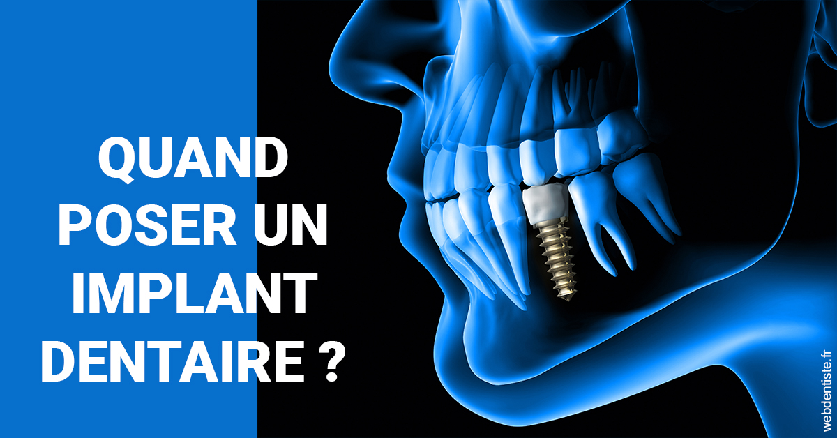 https://dr-olivier-lemaire.chirurgiens-dentistes.fr/Les implants 1