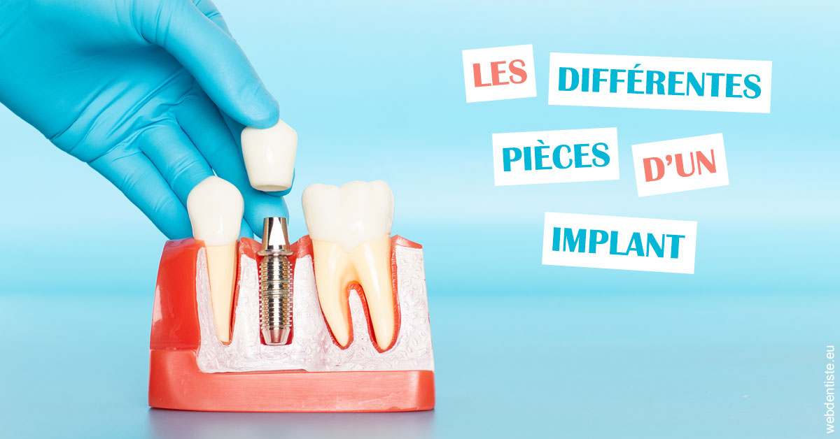 https://dr-olivier-lemaire.chirurgiens-dentistes.fr/Les différentes pièces d’un implant 2