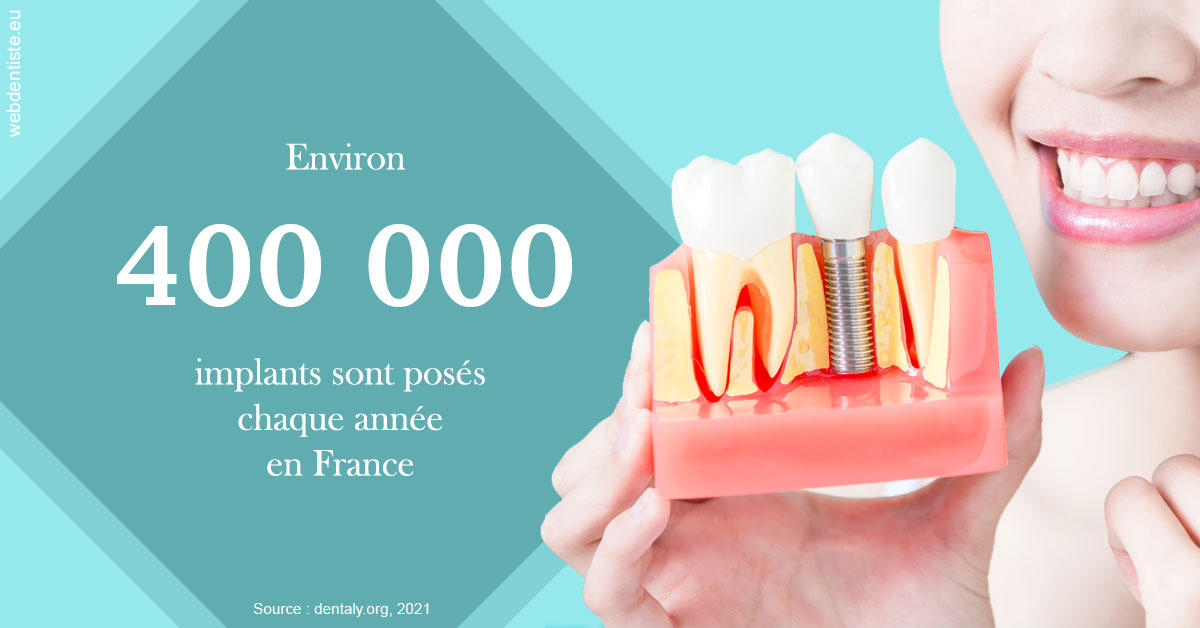 https://dr-olivier-lemaire.chirurgiens-dentistes.fr/Pose d'implants en France 2