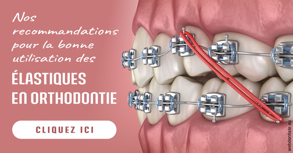 https://dr-olivier-lemaire.chirurgiens-dentistes.fr/Elastiques orthodontie 2